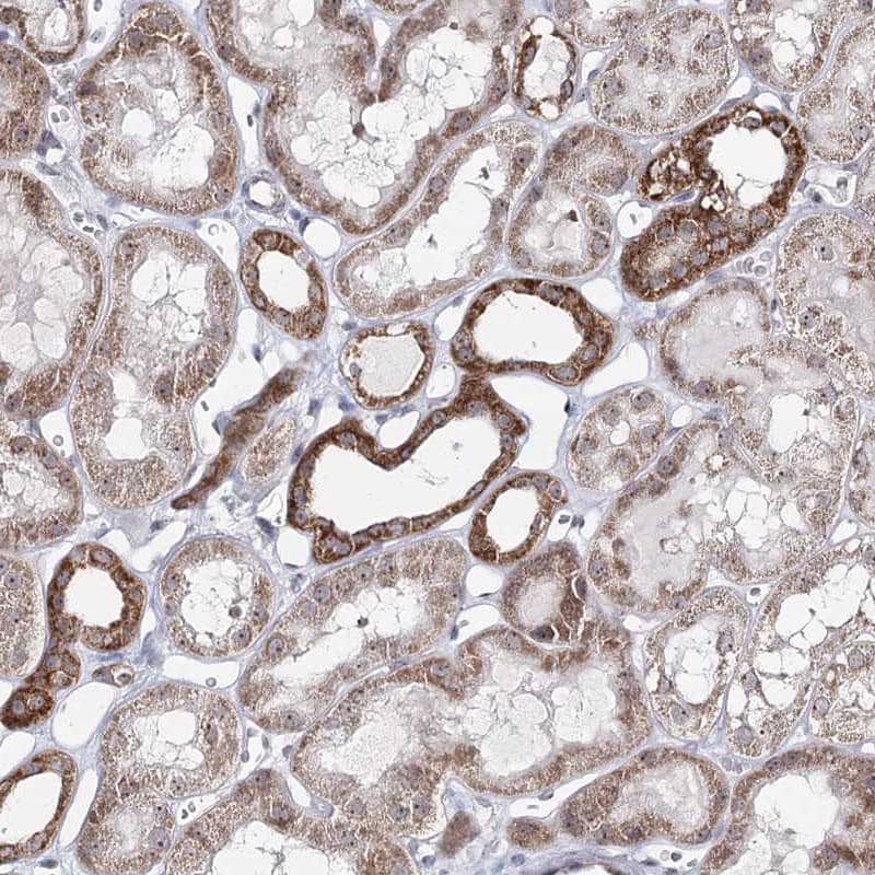 Staining of human kidney shows strong cytoplasmic positivity in a subset of tubules.