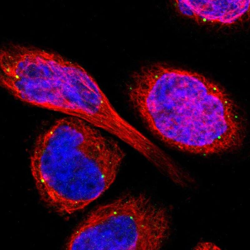 Staining of human cell line A-431 shows localization to vesicles.