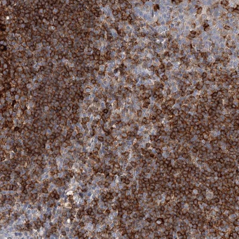 Staining of human tonsil shows strong cytoplasmic positivity in germinal center cells and non-germinal center cells.