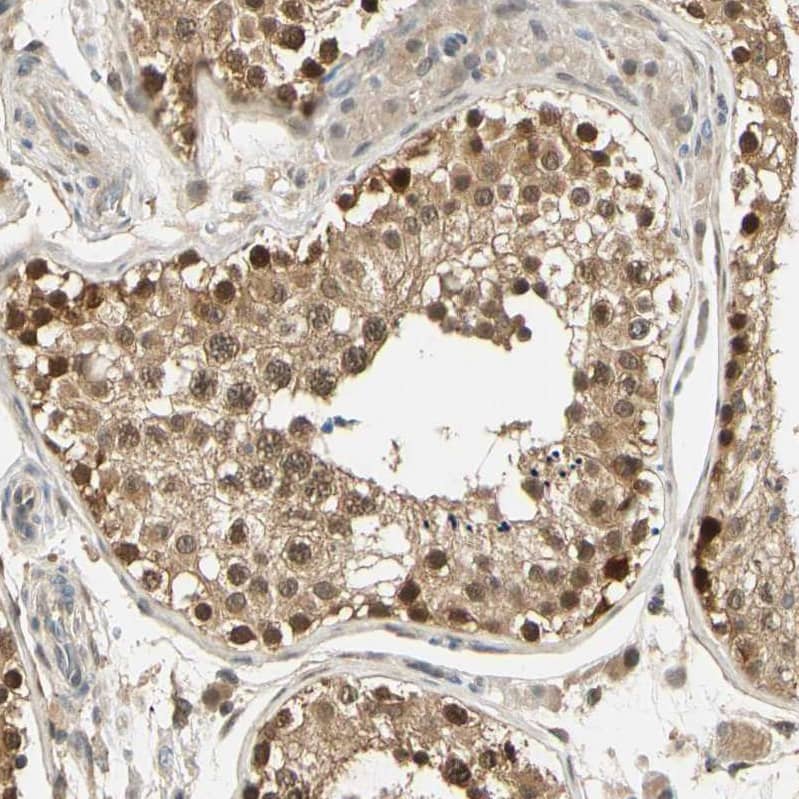 Staining of human testis shows moderate to strong nuclear and cytoplasmic positivity in cells in seminiferous ducts.