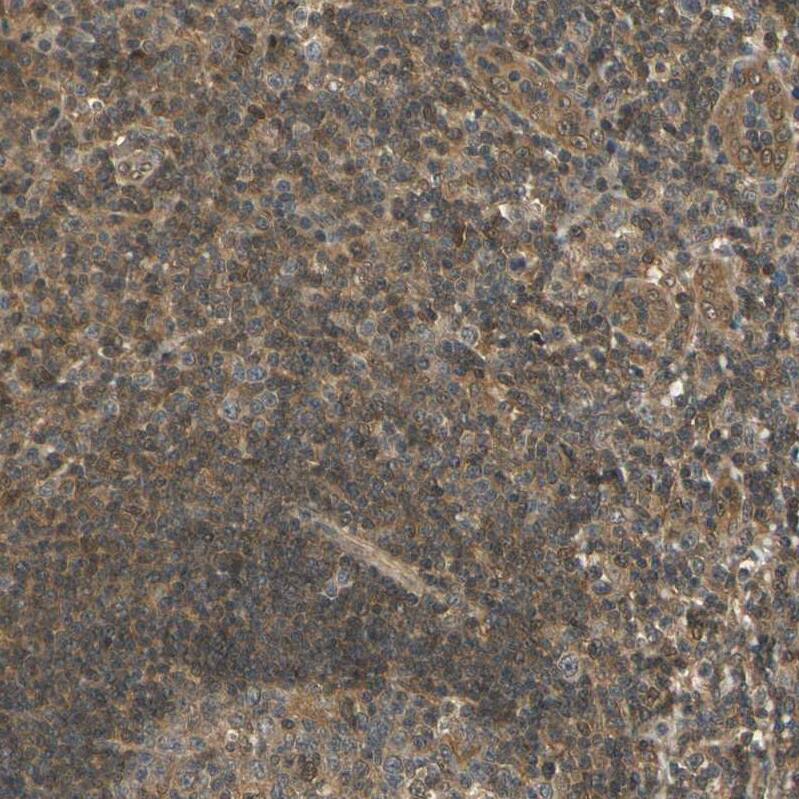 Staining of human tonsil shows moderate cytoplasmic positivity in non-germinal center cells.