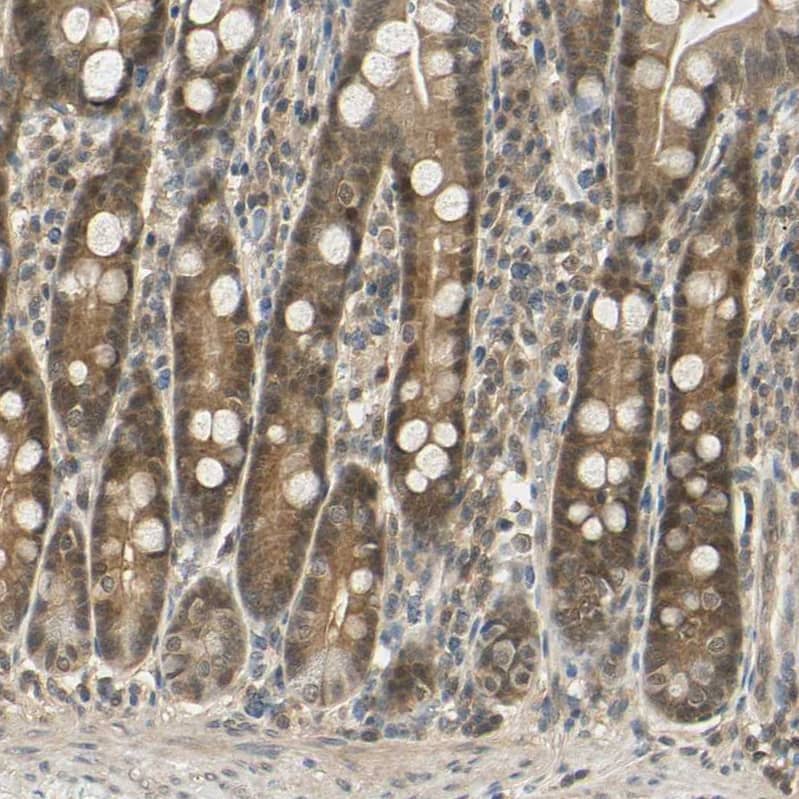 Staining of human duodenum shows moderate cytoplasmic and nuclear positivity in glandular cells.