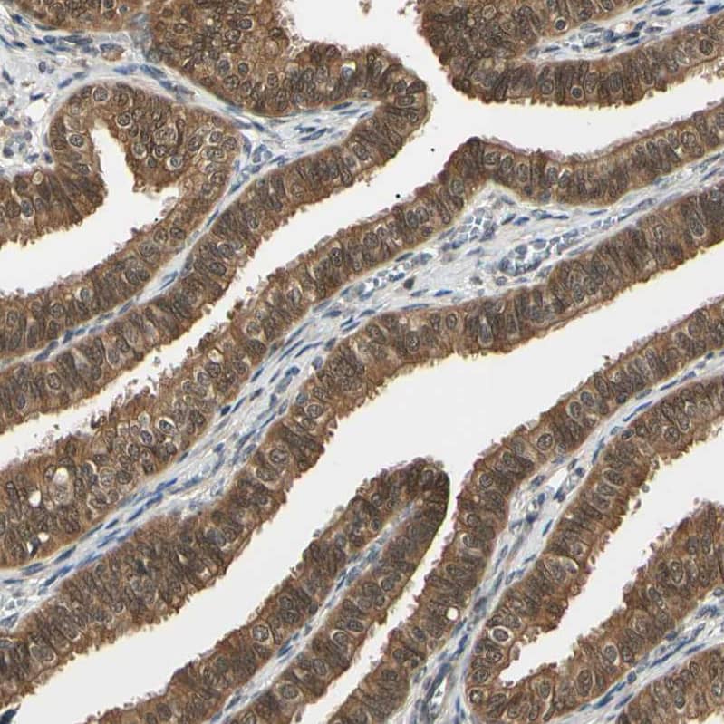 Staining of human fallopian tube shows moderate cytoplasmic and nuclear positivity in glandular cells.