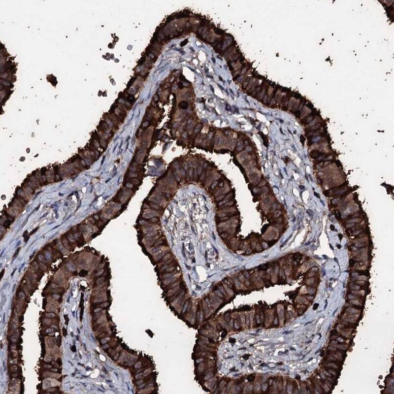 Immunohistochemistry-Paraffin OGFOD2 Antibody - BSA Free