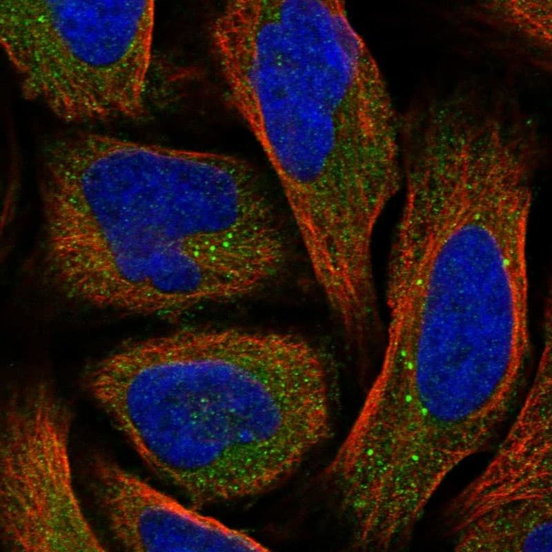Staining of human cell line U-2 OS shows positivity in cytoplasm & vesicles.