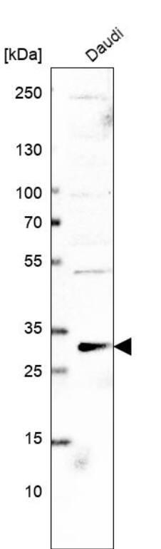 Westen Blot PLEKHF2 Antibody - BSA Free