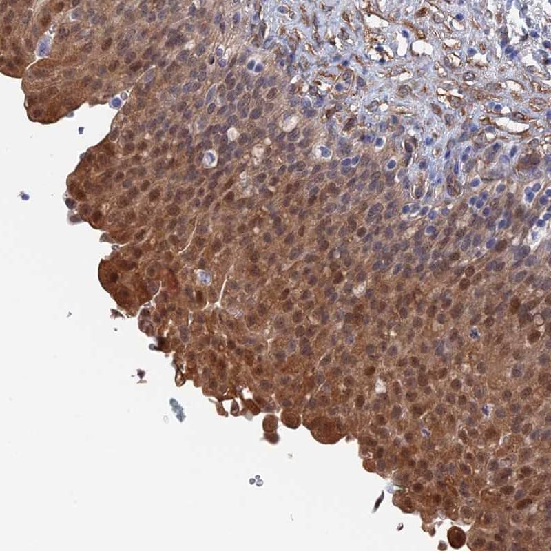 Staining of human urinary bladder shows moderate cytoplasmic and nuclear positivity in urothelium.