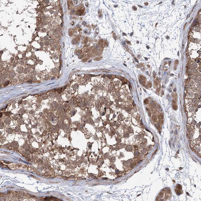 Staining of human testis shows moderate cytoplasmic positivity in cells in seminiferous ducts.