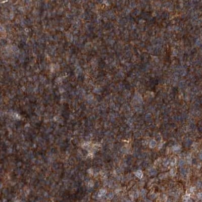 Staining of human lymph node.