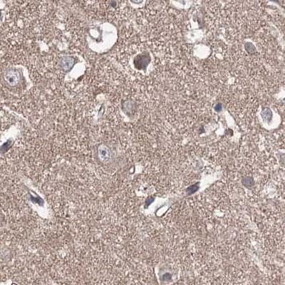 Staining of human cerebral cortex.