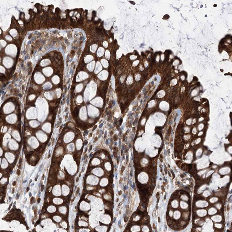 Staining of human colon shows strong cytoplasmic positivity in glandular cells.