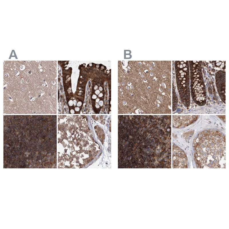 Staining of human cerebral cortex, colon, lymph node and testis HPA038217 (A) shows similar protein distribution across tissues to independent antibody HPA038218 (B).