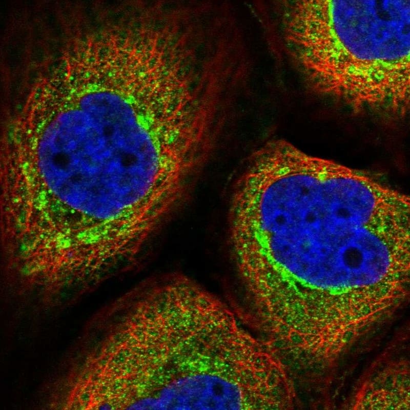 Staining of human cell line A-431 shows localization to cytosol & the Golgi apparatus.