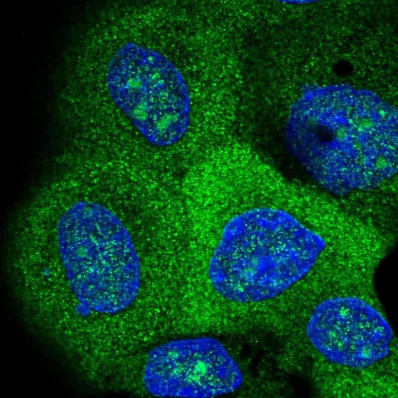 Staining of human cell line A-431 shows localization to nucleus, nucleoli & cytosol.