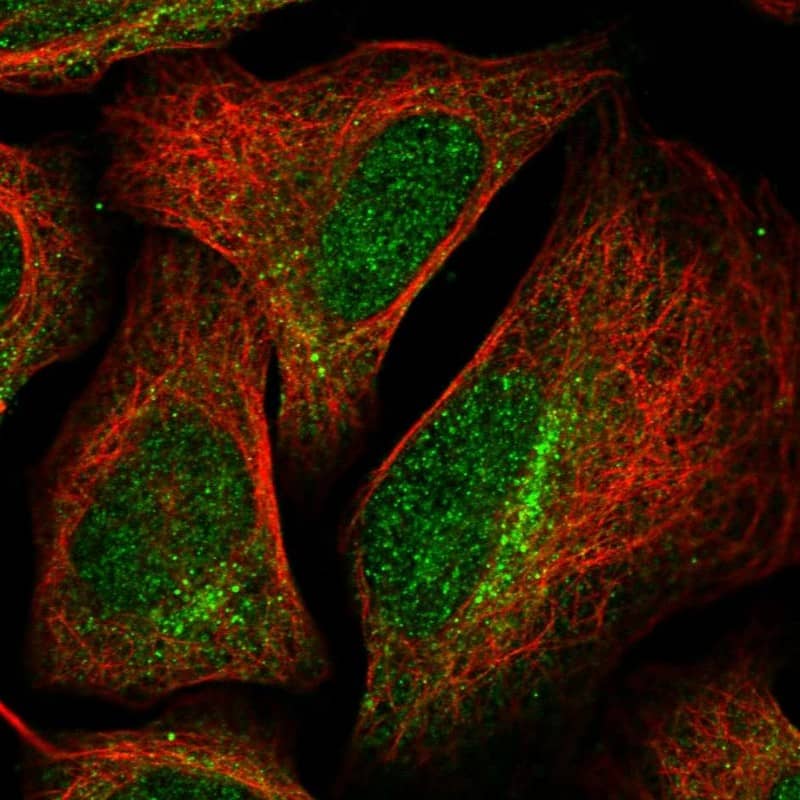 Immunocytochemistry/ Immunofluorescence TARS2 Antibody - BSA Free