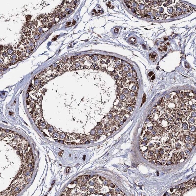 Staining of human testis shows strong cytoplasmic positivity in granular pattern in cells of seminiferus ducts.