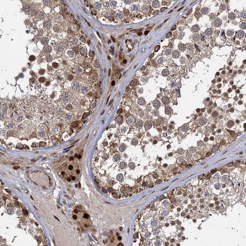 Immunohistochemistry-Paraffin GAL3ST4 Antibody - BSA Free