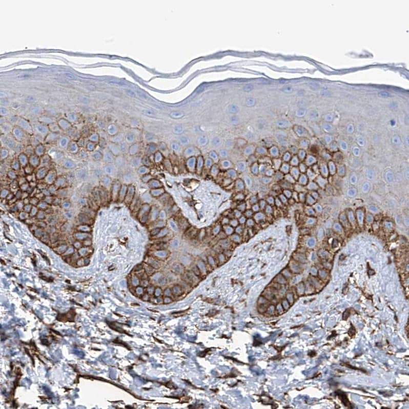 Staining of human skin shows moderate to strong membranous positivity in keratinocytes.