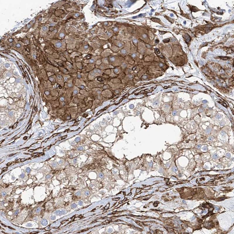 Staining of human testis shows moderate to strong membranous positivity in Leydig cells.