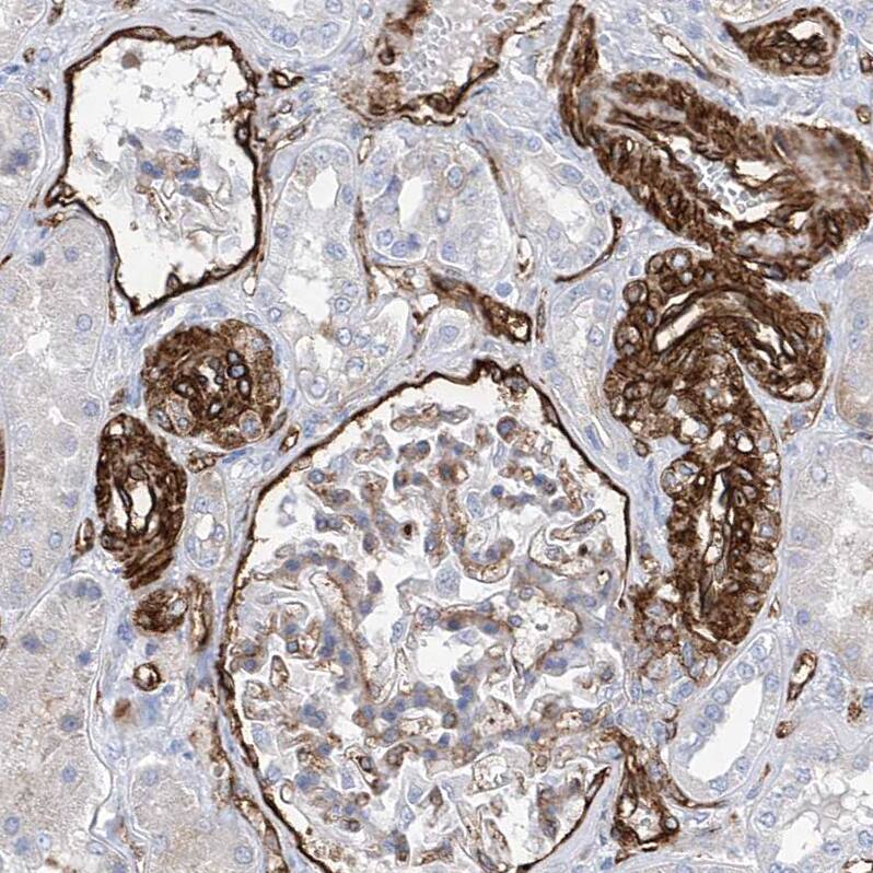 Staining of human kidney shows moderate to strong membranous positivity in cells in tubules.