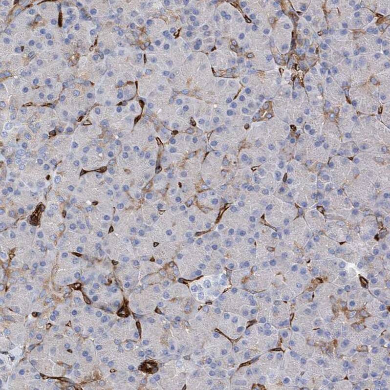 Staining of human pancreas shows moderate to strong membranous positivity in endothelial cells.