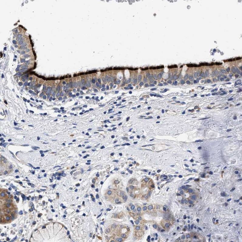 Immunohistochemistry-Paraffin RINT1 Antibody - BSA Free
