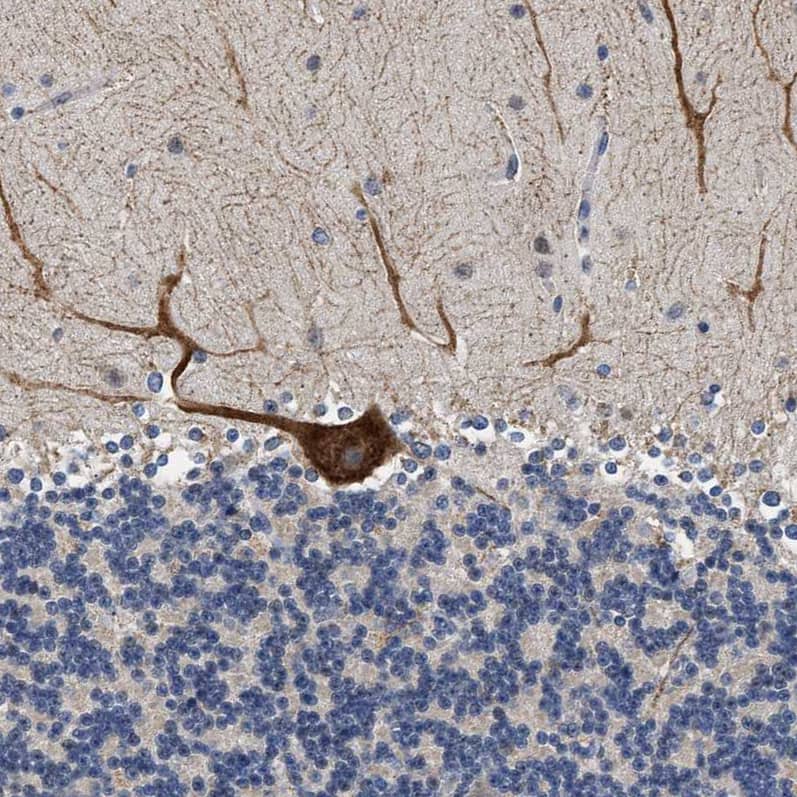 Immunohistochemistry-Paraffin RINT1 Antibody - BSA Free