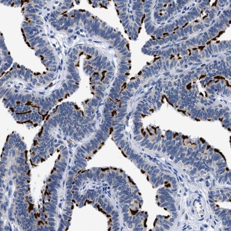 Immunohistochemistry-Paraffin RINT1 Antibody - BSA Free