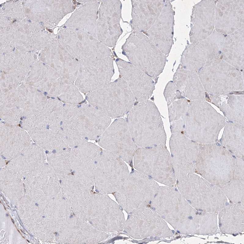 Staining of human skeletal muscle shows no positivity in myocytes as expected.