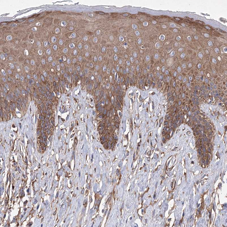 Staining of human skin shows strong cytoplasmic positivity in squamous epithelial cells.