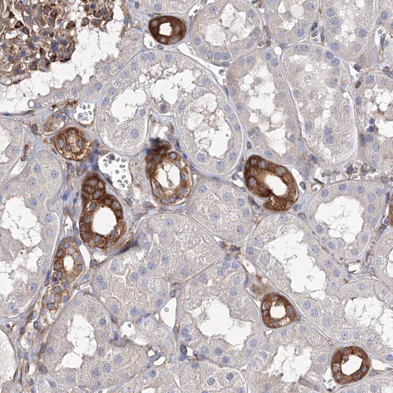 Staining of human kidney shows strong cytoplasmic positivity in cells in tubules.
