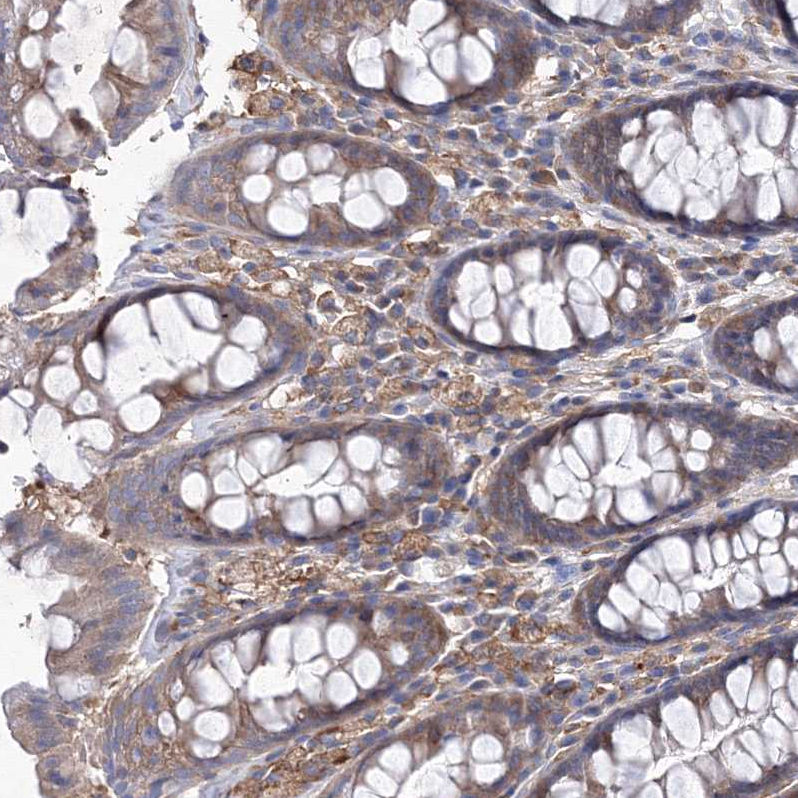 Staining of human rectum shows strong cytoplasmic positivity in lymphoid cells.