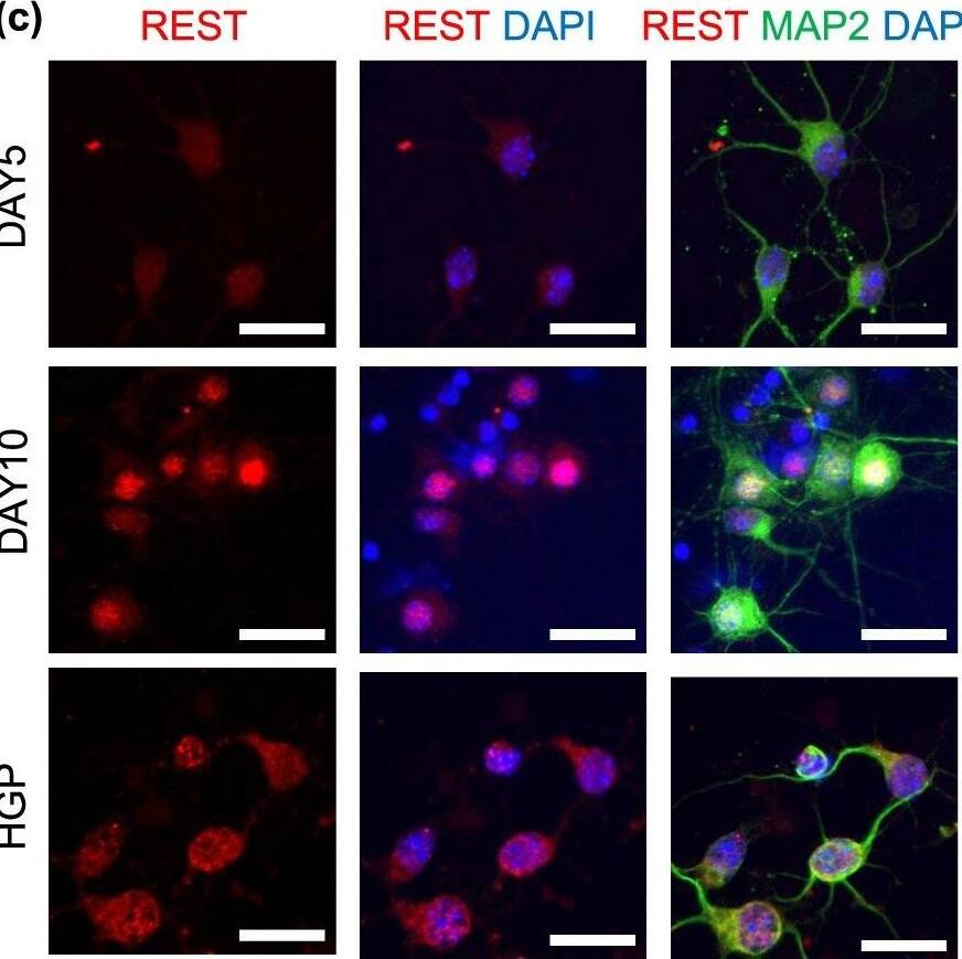 Expression and distribution of REST after treatment of HGP a Western blotting image of REST in PC12 cells at control and HGP. b Western blotting image of REST in PCNs at control and HGP. c Immunofluorescence staining of REST in PCNs at Day5, Day10 and HGP. Scale bar, 25 μm. d Nuclear fluorescence intensity of REST. e The expression level of REST in cytoplasm and nucleus of PC12 cells under HGP. Data are mean +/- SD. n = 3 independent experiments. *p < 0.05, **p < 0.01, ***p < 0.001, ****p < 0.0001. Unpaired t test for (a), (b) and (e). One-way ANOVA for (d) Image collected and cropped by CiteAb from the following open publication (//pubmed.ncbi.nlm.nih.gov/35850767), licensed under a CC-BY license. Not internally tested by Novus Biologicals.