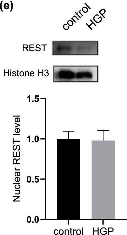 Expression and distribution of REST after treatment of HGP a Western blotting image of REST in PC12 cells at control and HGP. b Western blotting image of REST in PCNs at control and HGP. c Immunofluorescence staining of REST in PCNs at Day5, Day10 and HGP. Scale bar, 25 μm. d Nuclear fluorescence intensity of REST. e The expression level of REST in cytoplasm and nucleus of PC12 cells under HGP. Data are mean +/- SD. n = 3 independent experiments. *p < 0.05, **p < 0.01, ***p < 0.001, ****p < 0.0001. Unpaired t test for (a), (b) and (e). One-way ANOVA for (d) Image collected and cropped by CiteAb from the following open publication (//pubmed.ncbi.nlm.nih.gov/35850767), licensed under a CC-BY license. Not internally tested by Novus Biologicals.