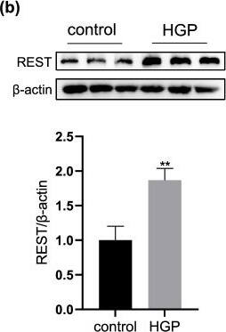 Expression and distribution of REST after treatment of HGP a Western blotting image of REST in PC12 cells at control and HGP. b Western blotting image of REST in PCNs at control and HGP. c Immunofluorescence staining of REST in PCNs at Day5, Day10 and HGP. Scale bar, 25 μm. d Nuclear fluorescence intensity of REST. e The expression level of REST in cytoplasm and nucleus of PC12 cells under HGP. Data are mean +/- SD. n = 3 independent experiments. *p < 0.05, **p < 0.01, ***p < 0.001, ****p < 0.0001. Unpaired t test for (a), (b) and (e). One-way ANOVA for (d) Image collected and cropped by CiteAb from the following open publication (//pubmed.ncbi.nlm.nih.gov/35850767), licensed under a CC-BY license. Not internally tested by Novus Biologicals.