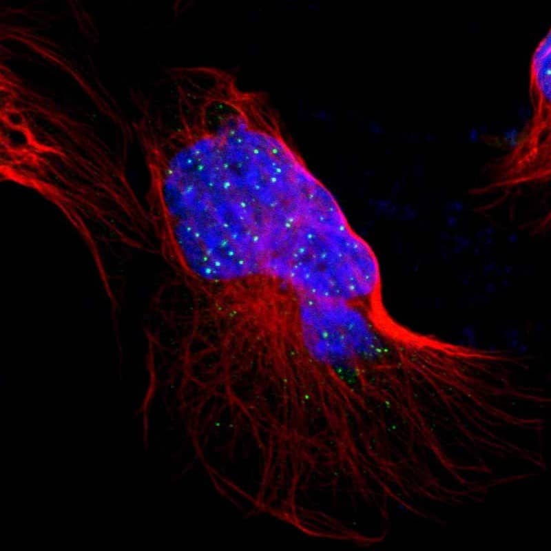 Staining of human cell line U-2 OS shows localization to nuclear bodies.