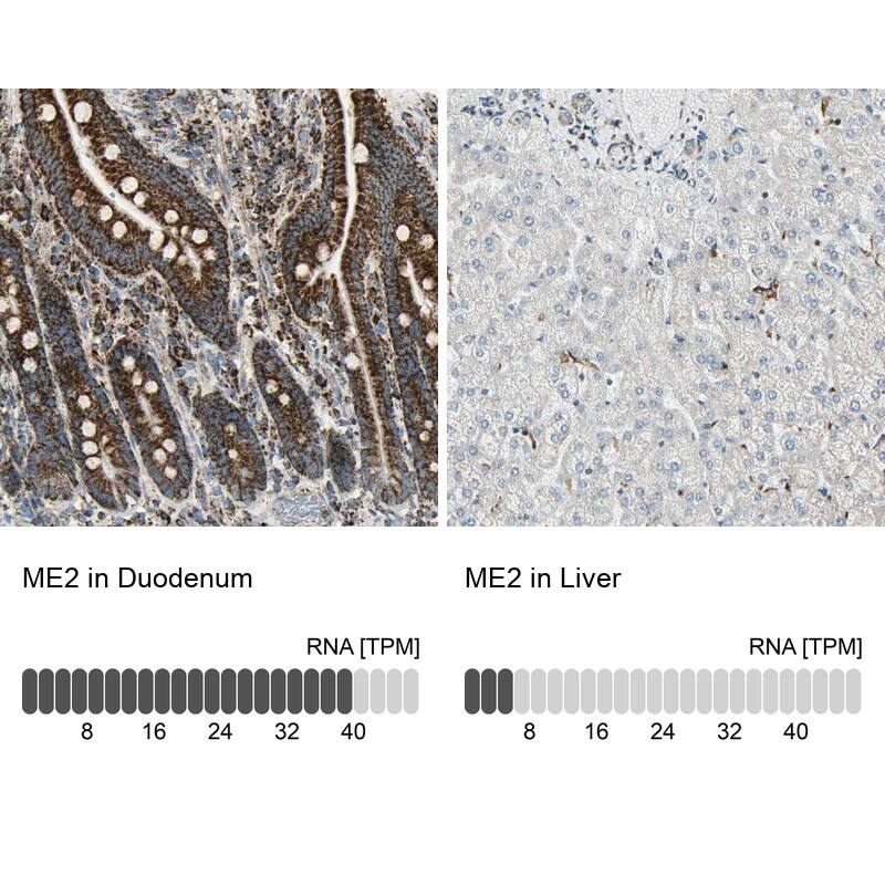 <b>Orthogonal Strategies Validation. </b>Analysis in human duodenum and liver tissues.