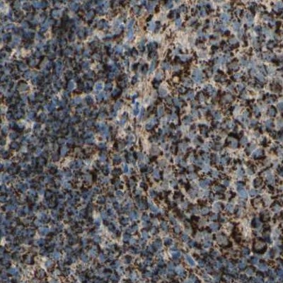 Staining of human lymph node.