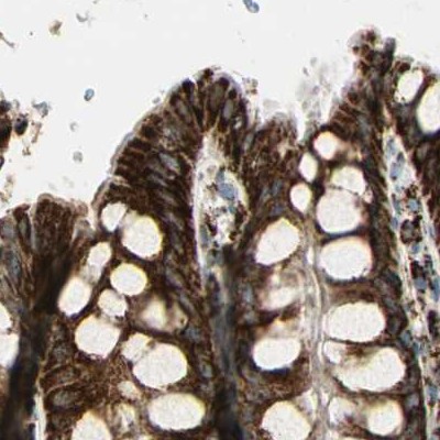 Staining of human colon.