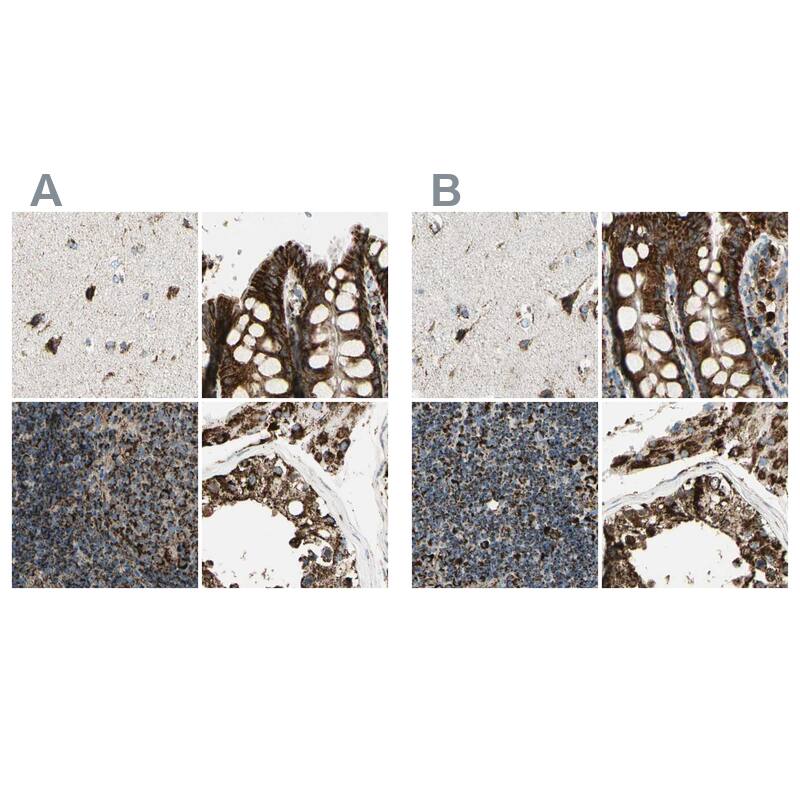 <b>Orthogonal Strategies Validation. </b>Staining of human cerebral cortex, colon, lymph node and testis HPA008247 (A) shows similar protein distribution across tissues to independent antibody HPA008880 (B).