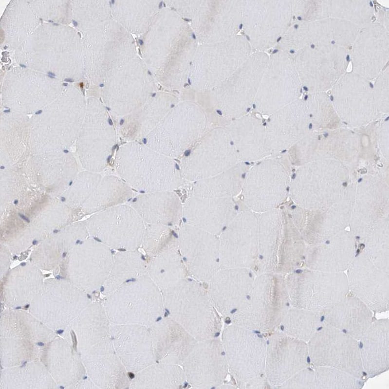Immunohistochemistry-Paraffin P2Y10/P2RY10 Antibody - BSA Free