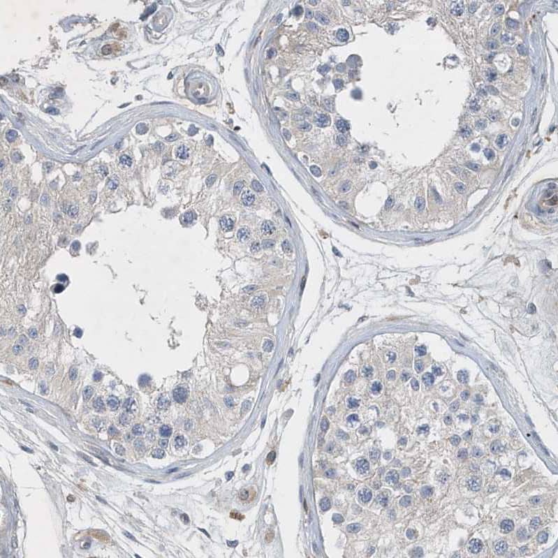 Immunohistochemistry-Paraffin P2Y10/P2RY10 Antibody - BSA Free