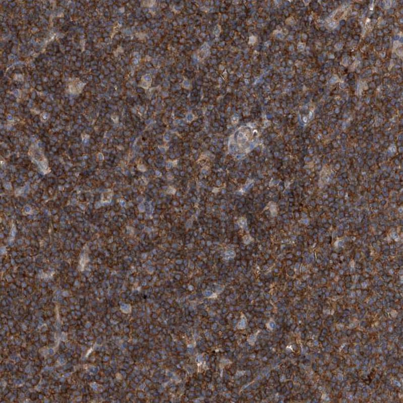 Immunohistochemistry-Paraffin P2Y10/P2RY10 Antibody - BSA Free