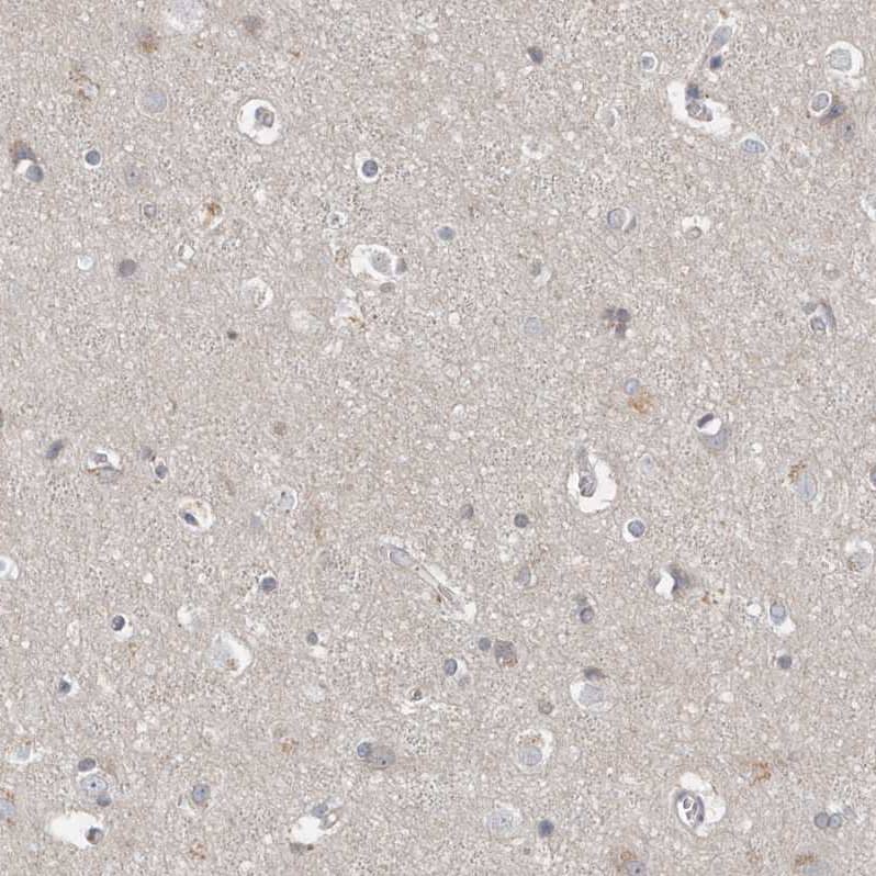 Staining of human cerebral cortex shows no positivity in neurons as expected.