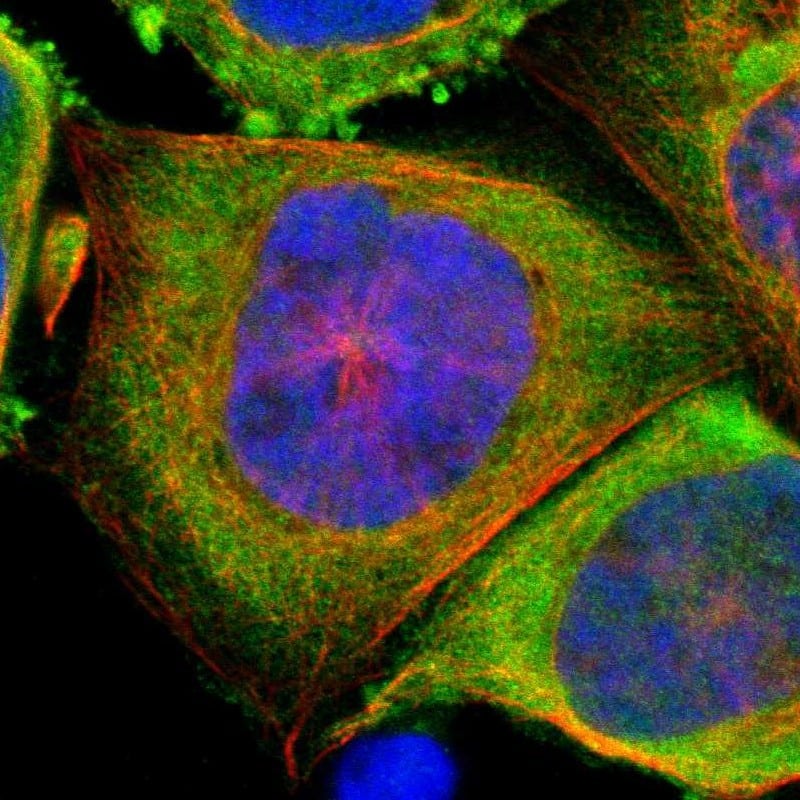 Staining of human cell line A-431 shows positivity in cytoplasm.