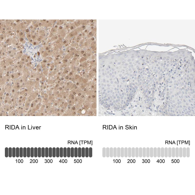 Immunohistochemistry-Paraffin HRSP12 Antibody - BSA Free