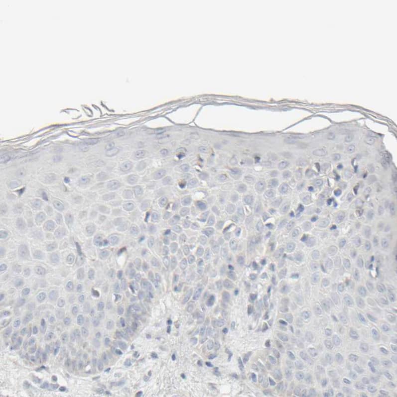 Immunohistochemistry-Paraffin HRSP12 Antibody - BSA Free