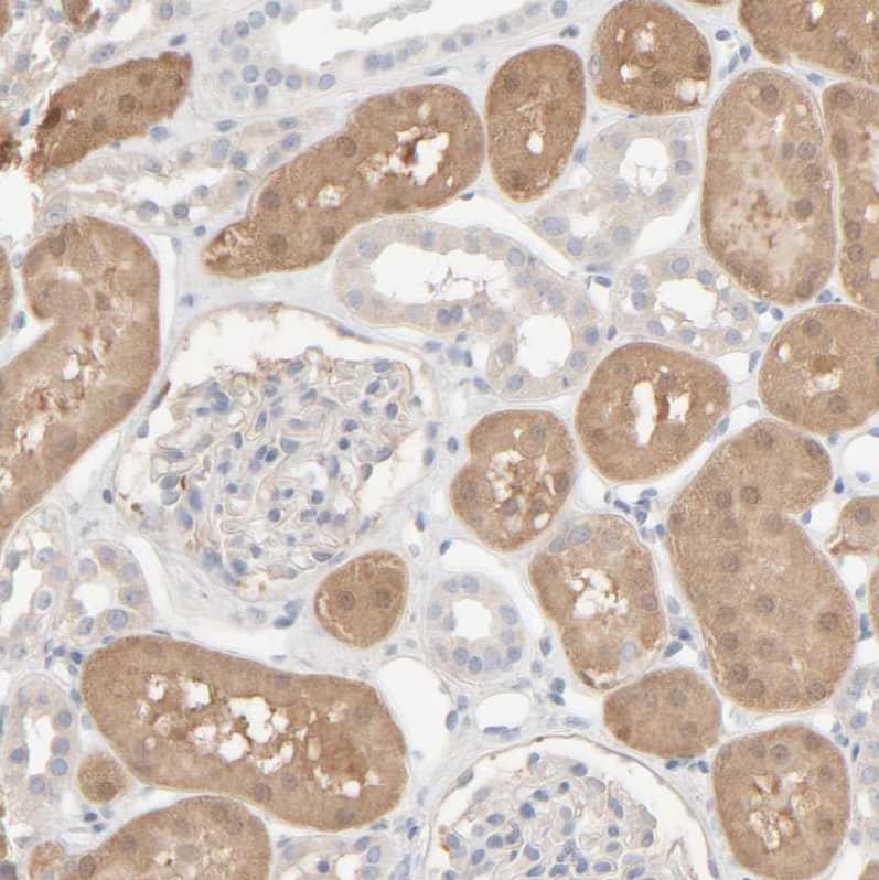 Immunohistochemistry-Paraffin HRSP12 Antibody - BSA Free