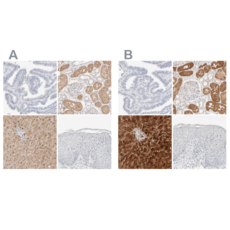 Immunohistochemistry-Paraffin HRSP12 Antibody - BSA Free