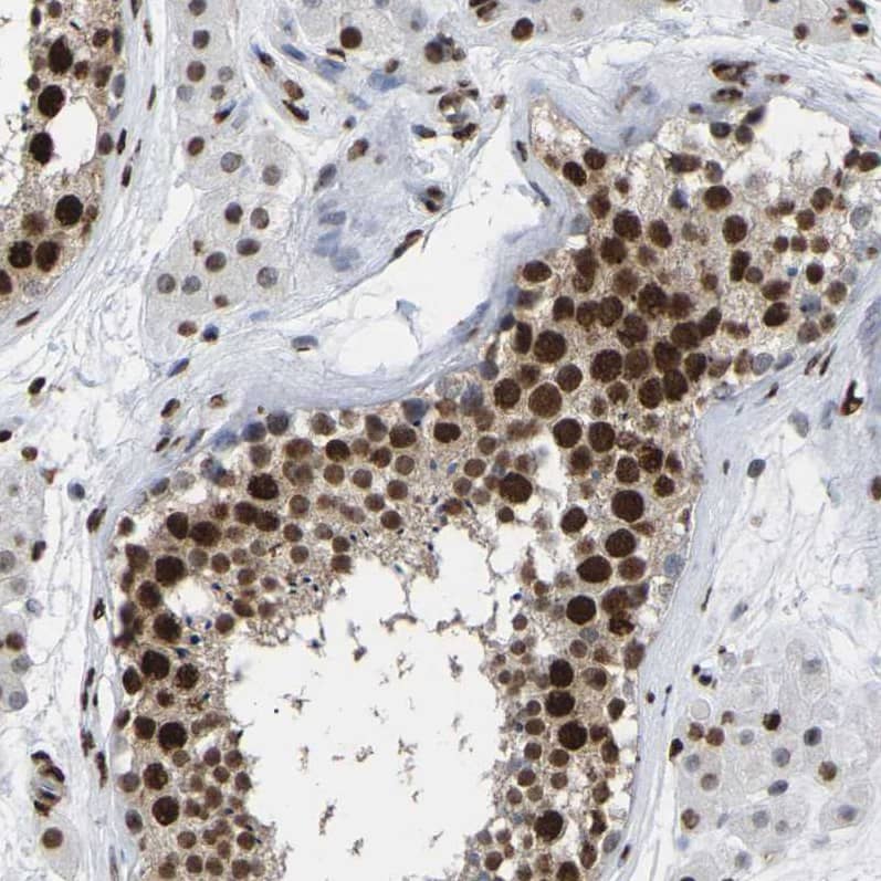Staining of human testis shows strong nuclear positivity in cells in seminiferous ducts.